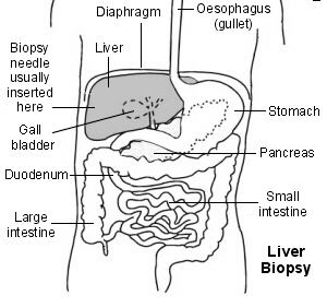 http://curezone.com/upload/Blogs/liver11.gif