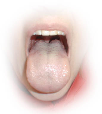 http://curezone.com/upload/Blogs/toxictonguejpg.jpg